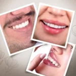 Close-up collage of smiling men and women showing clean