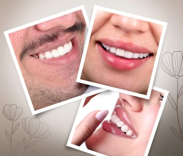 Close-up collage of smiling men and women showing clean