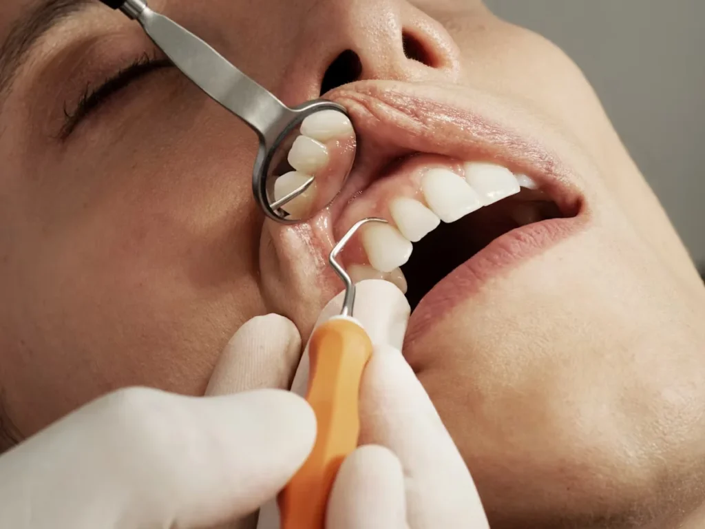 Gingivitis vs Periodontitis Early Signs and When to See a Dentist