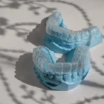 Invisalign vs Braces: Treatment Time, Maintenance, and Results