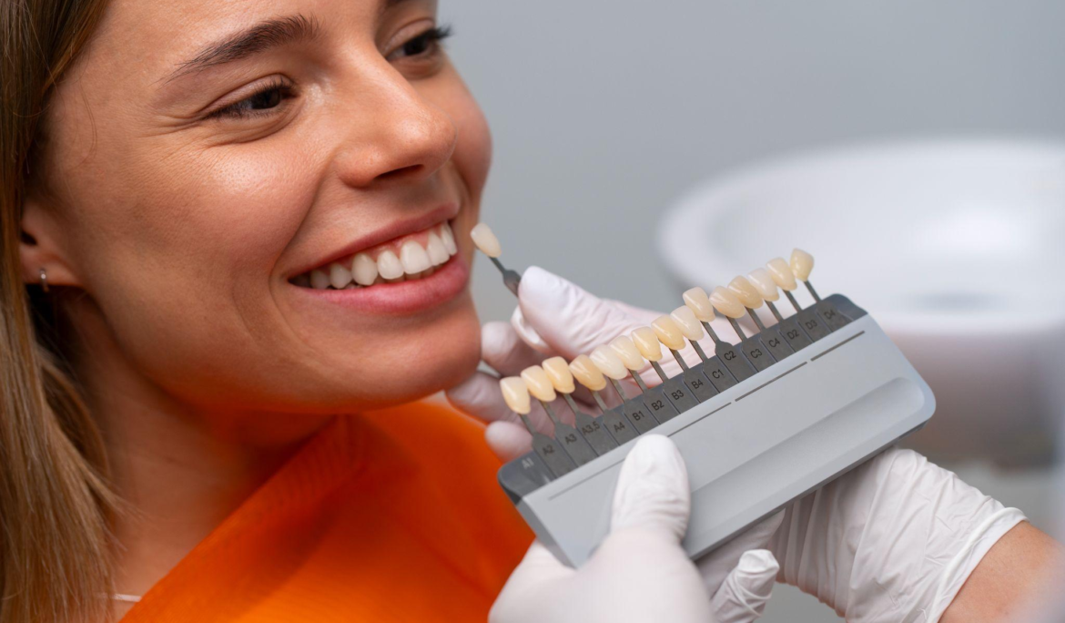 A woman getting the tooth shade matched for veneers