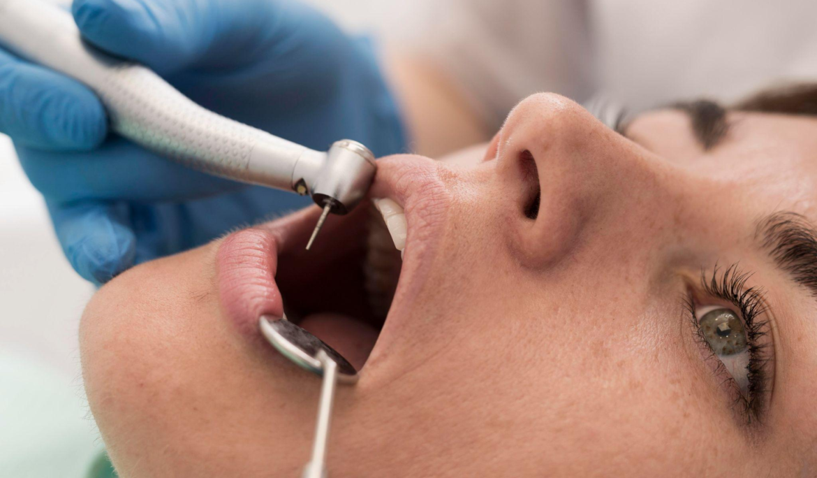 A dentist offering the dental filling treatment to a woman