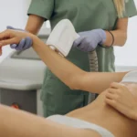 laser-epilation-hair-removal-therapy