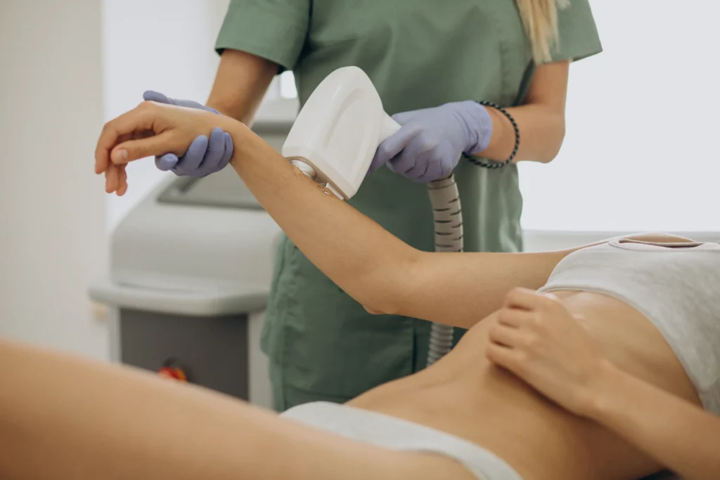 laser-epilation-hair-removal-therapy