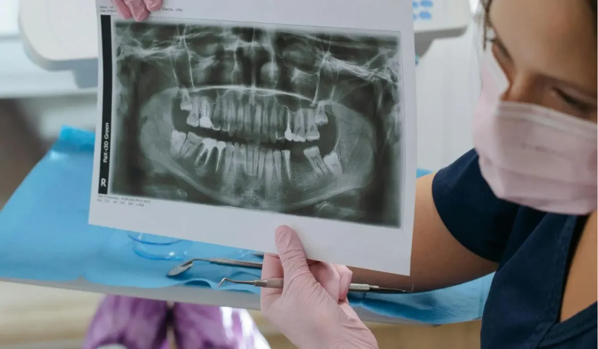 Crooked Teeth Causes, Effects, and When to See a Dentist