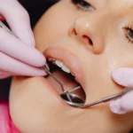 Deep dental cleaning procedure with advanced tools for gum health