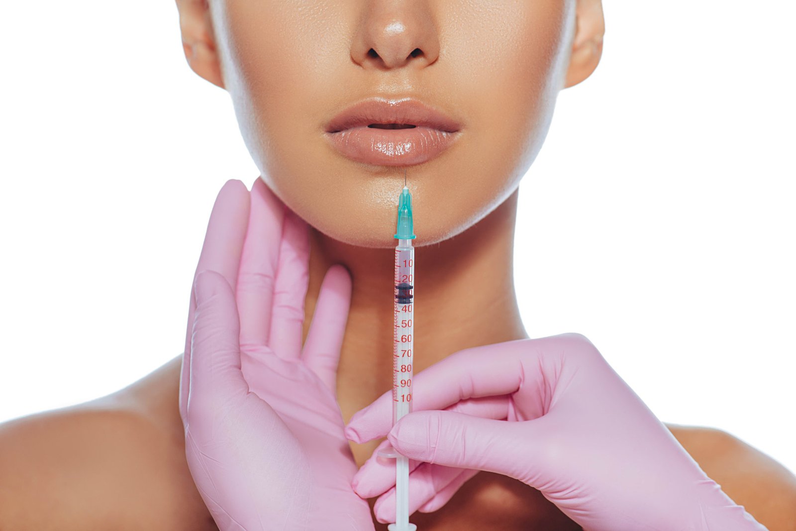 dermal filler