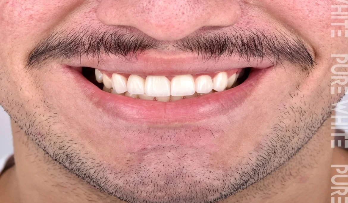man with smiling face and healthy white teeth