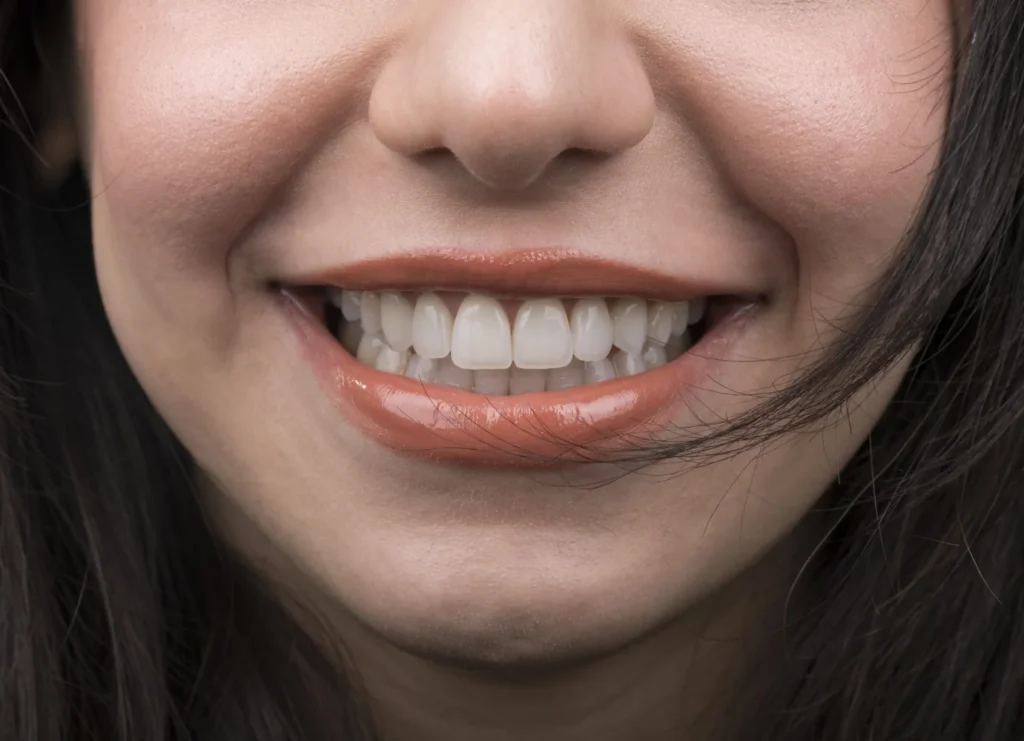Girl with perfect white teeth