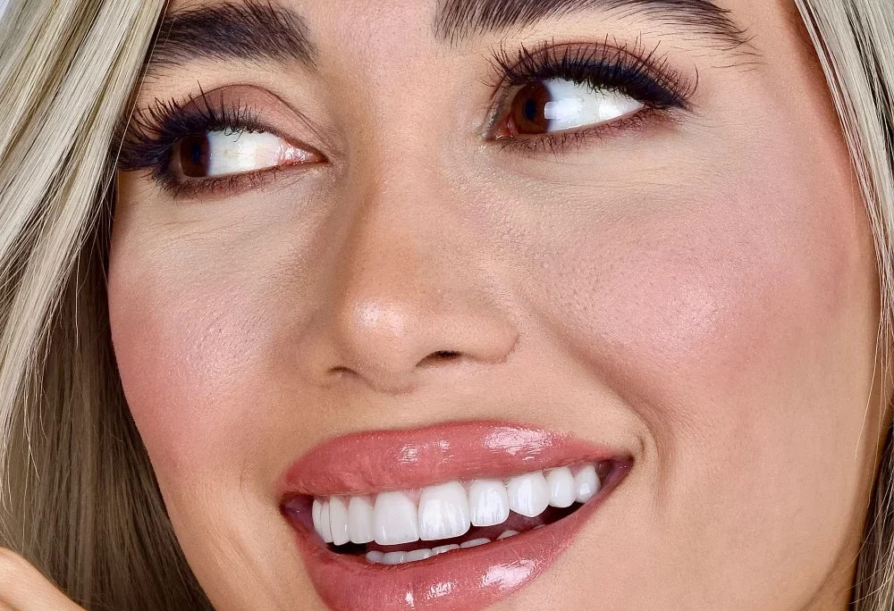 lady with beautiful smile and perfect white teeth