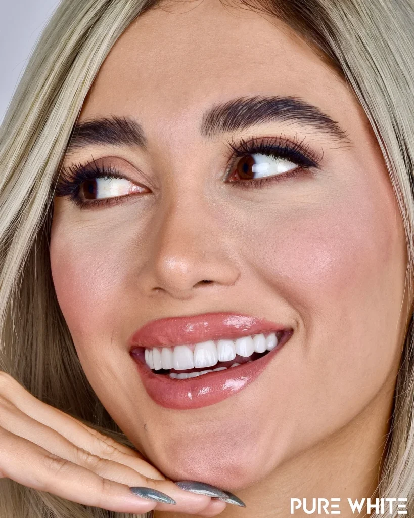 lady with beautiful smile and perfect white teeth