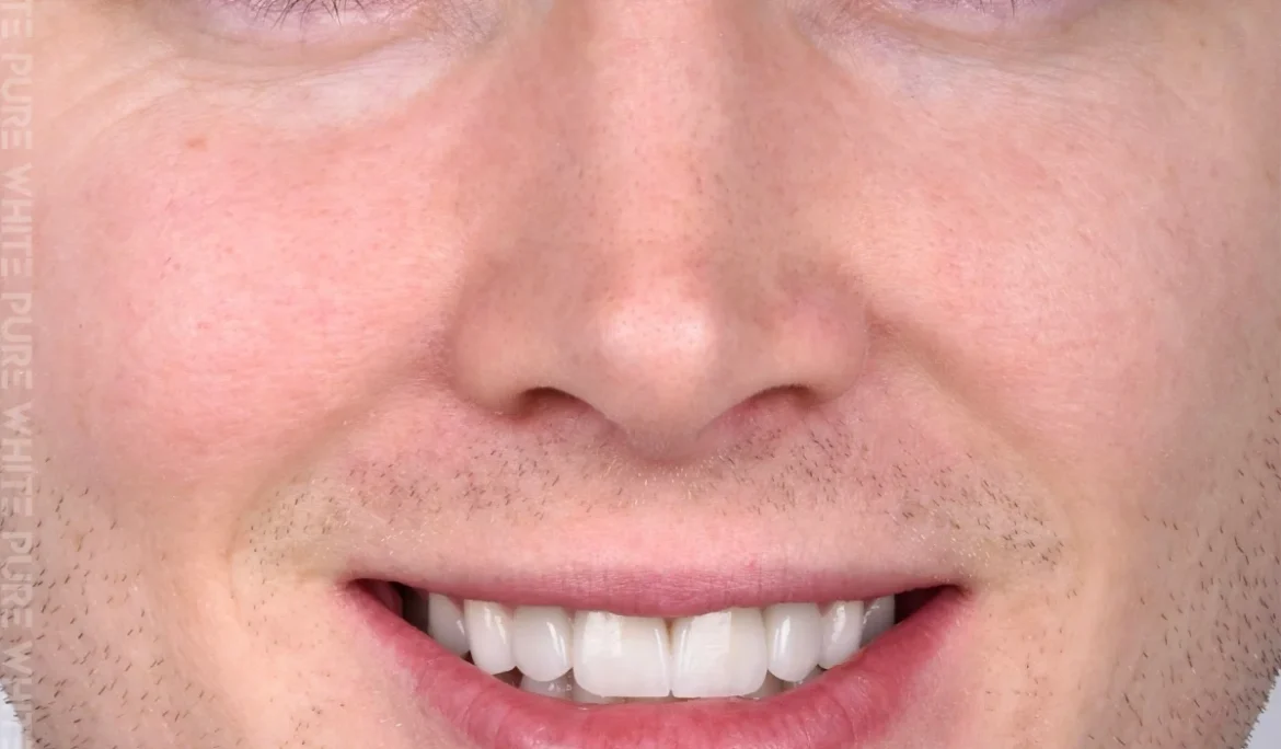 smiling face of a man with perfect teeth