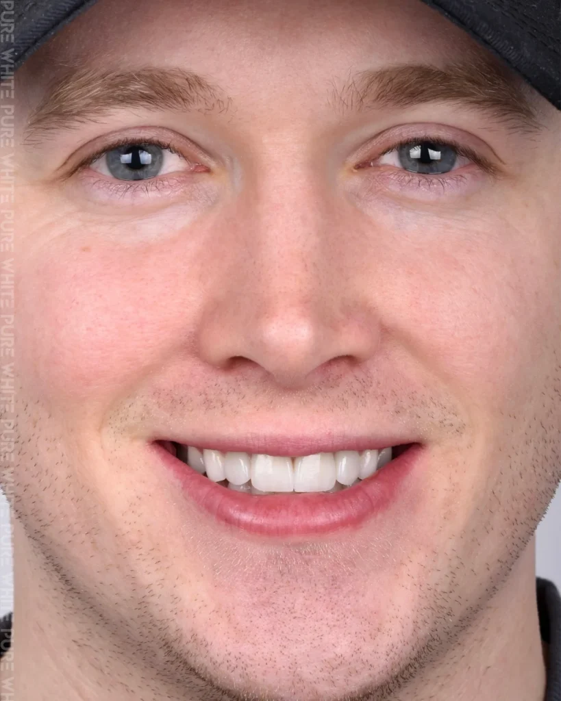 smiling face of a man with perfect teeth